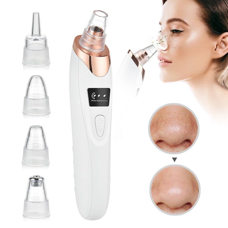 Blackhead Remover Exfoliating Beauty Device - Pakisma