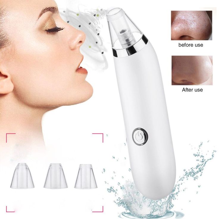 Blackhead Remover Exfoliating Beauty Device - Pakisma